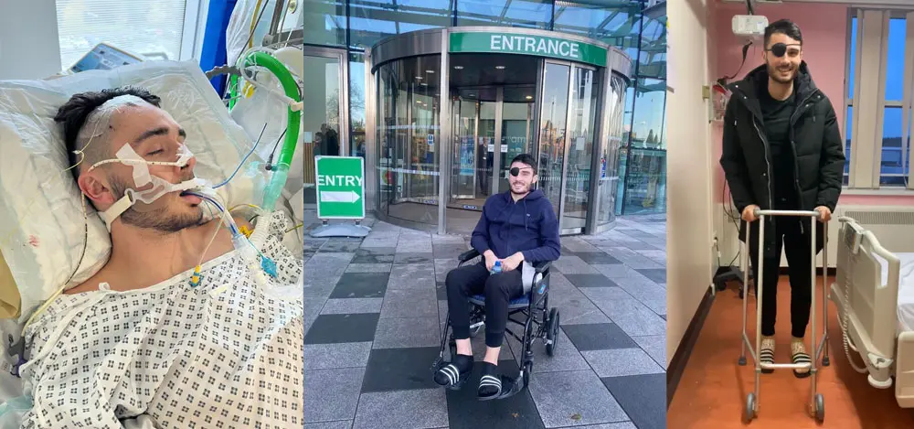 Alex Fletcher ผ่าตัดสมองฉุกเฉิน By KUBET